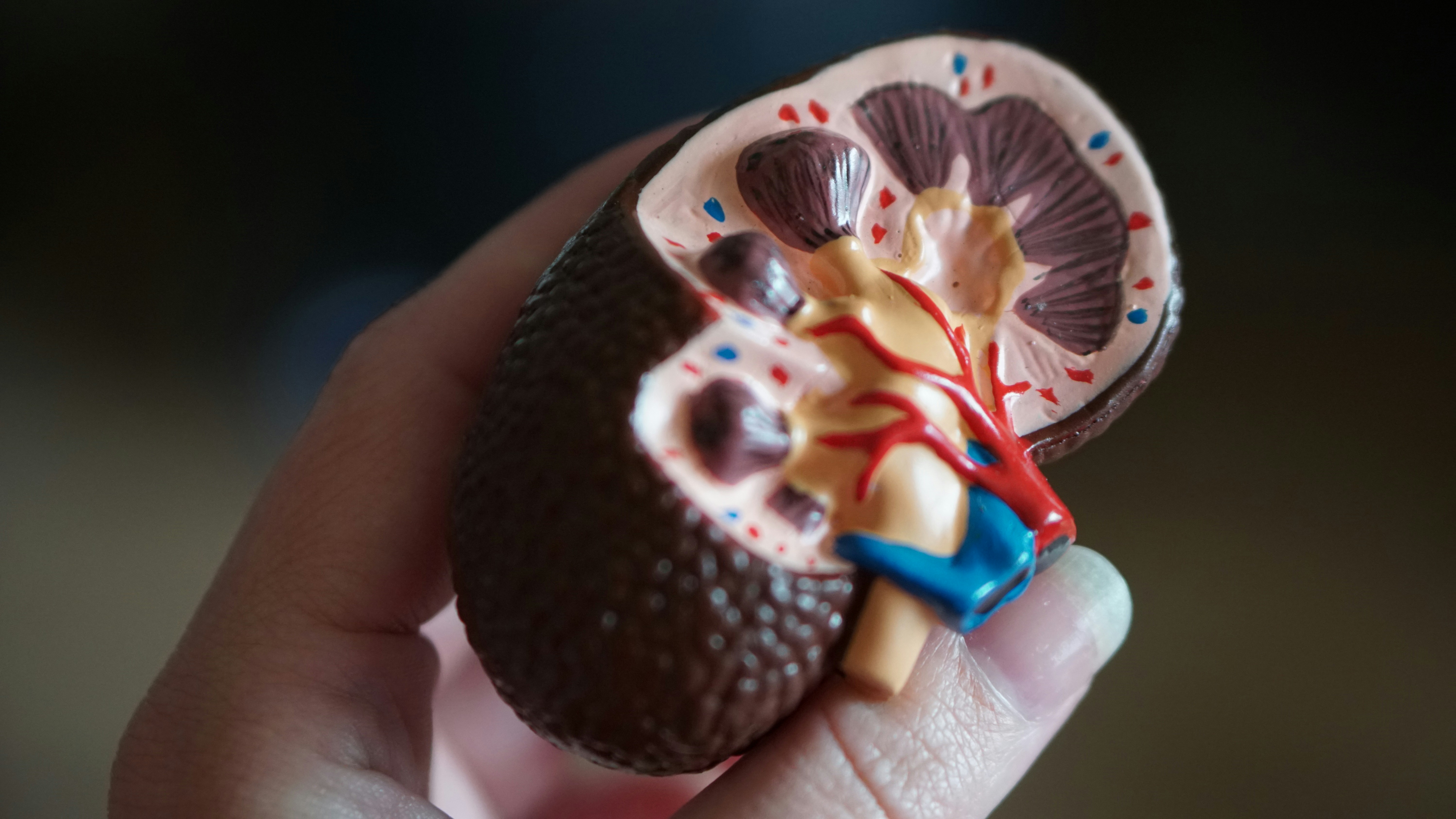 Anatomical kidney model — the focus of our therapeutic work